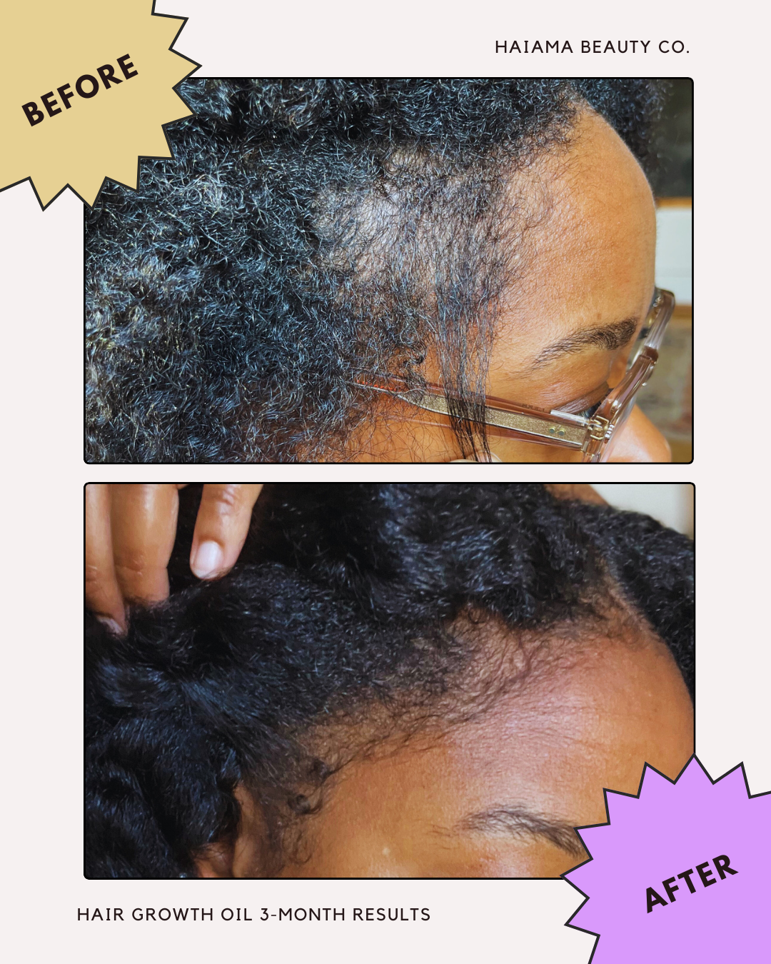 Organic Hair Growth Oil