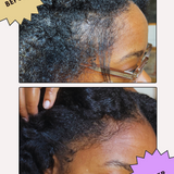 Organic Hair Growth Oil