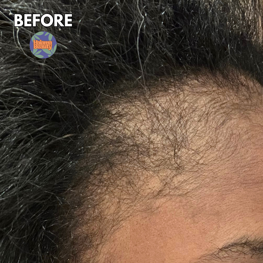 Postpartum Hair Loss: What Causes Shedding + How to Support Hair Growth After Pregnancy