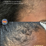 The Leona Bundle by Haiama Beauty | Red Light Therapy for Hair Growth & Growth Elixir 2oz